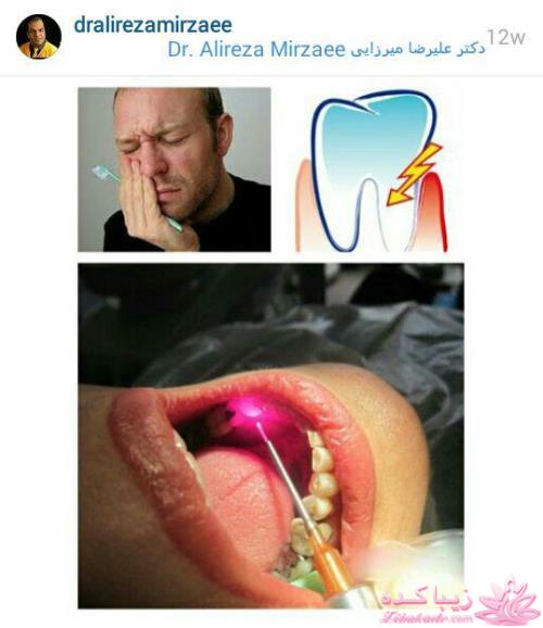 درمان دندان های حساس توسط لیزر